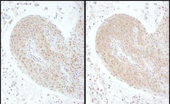 Rabbit PSMC6 Antibody