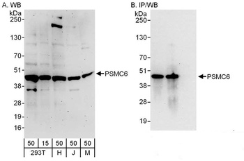 Rabbit PSMC6 Antibody
