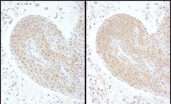 Rabbit PSMC6 Antibody