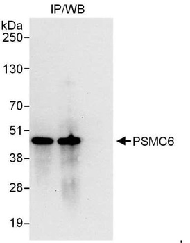 Rabbit PSMC6 Antibody