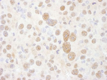 Rabbit PSMC2 Antibody