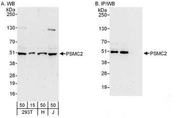 Rabbit PSMC2 Antibody