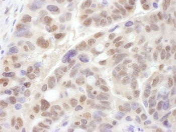 Rabbit PSMC1 Antibody