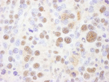 Rabbit PSMC1 Antibody