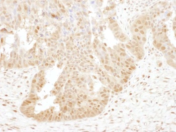 Rabbit anti-PSMB4 Antibody