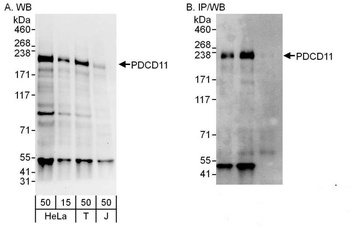 Rabbit PDCD11 Antibody