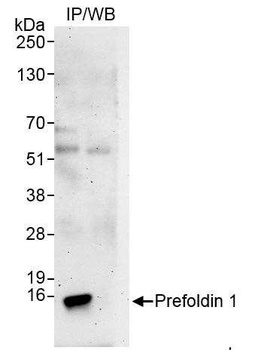 Rabbit Prefoldin 1 Antibody
