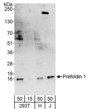 Rabbit Prefoldin 1 Antibody