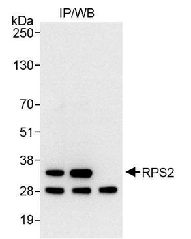 Rabbit RPS2 Antibody