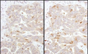 Rabbit Beta-Arrestin 2 Antibody
