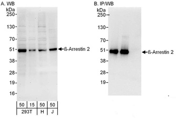 Rabbit Beta-Arrestin 2 Antibody