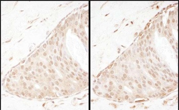 Rabbit Beta-Arrestin 2 Antibody