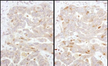 Rabbit Beta-Arrestin 2 Antibody