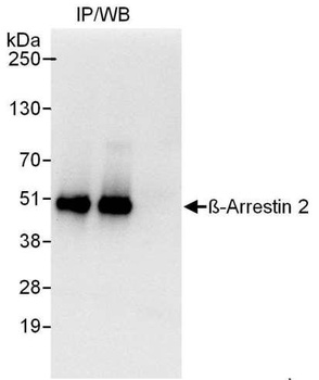 Rabbit Beta-Arrestin 2 Antibody