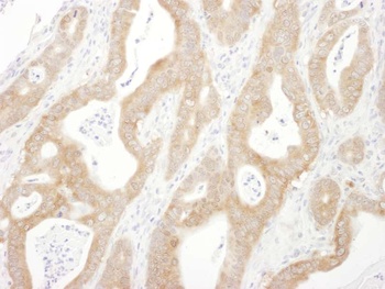 Rabbit Beta-Arrestin 1 Antibody