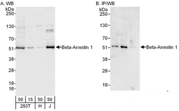Rabbit Beta-Arrestin 1 Antibody