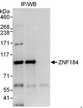 Rabbit ZNF184 Antibody