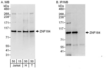 Rabbit ZNF184 Antibody