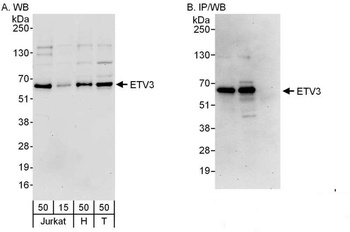 Rabbit anti-ETV3 Antibody