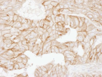 Rabbit anti-Alpha-Adducin Antibody