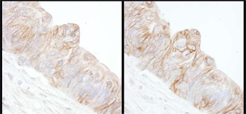 Rabbit anti-Alpha-Adducin Antibody
