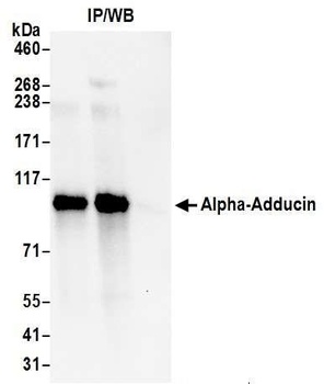 Rabbit anti-Alpha-Adducin Antibody