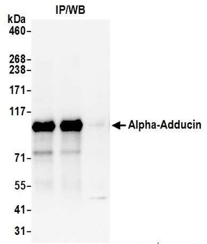 Rabbit anti-Alpha-Adducin Antibody