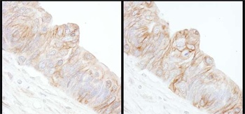 Rabbit anti-Alpha-Adducin Antibody