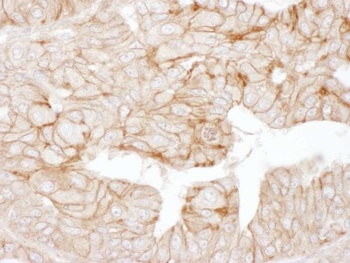 Rabbit anti-Alpha-Adducin Antibody