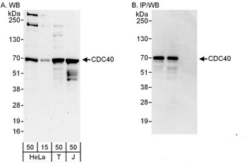 Rabbit CDC40 Antibody