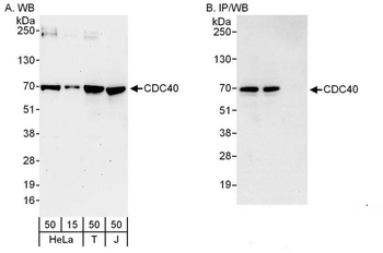 Rabbit CDC40 Antibody