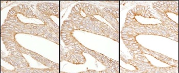 Rabbit Calnexin Antibody