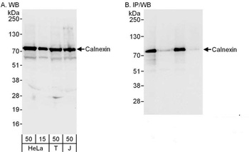 Rabbit Calnexin Antibody