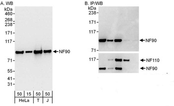 Rabbit NF90 Antibody