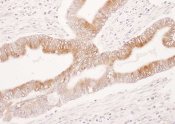 Rabbit COX-2 Antibody