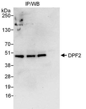 Rabbit DPF2 Antibody