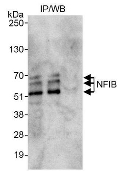 Rabbit NFIB Antibody