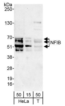 Rabbit NFIB Antibody