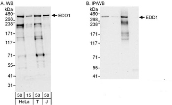 Rabbit EDD1 Antibody