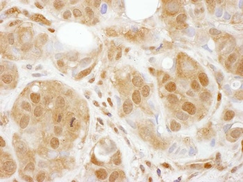 Rabbit TBP1 Antibody