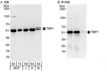 Rabbit TBP1 Antibody