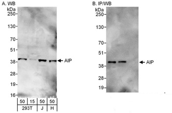 Rabbit AIP Antibody