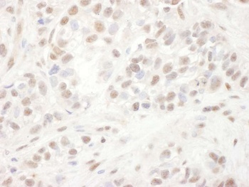 Rabbit ELK1 Antibody