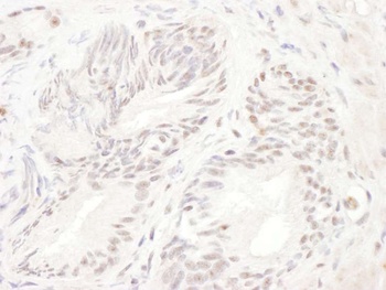 Rabbit ELK1 Antibody