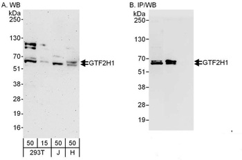 Rabbit anti-GTF2H1 Antibody