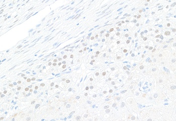 Rabbit GATA4 Antibody