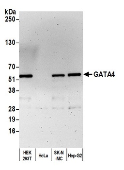 Rabbit GATA4 Antibody