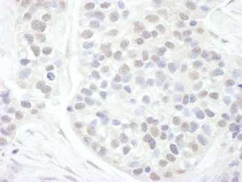 Rabbit Cyclin T1 Antibody