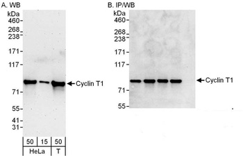Rabbit Cyclin T1 Antibody