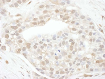 Rabbit Cyclin T1 Antibody
